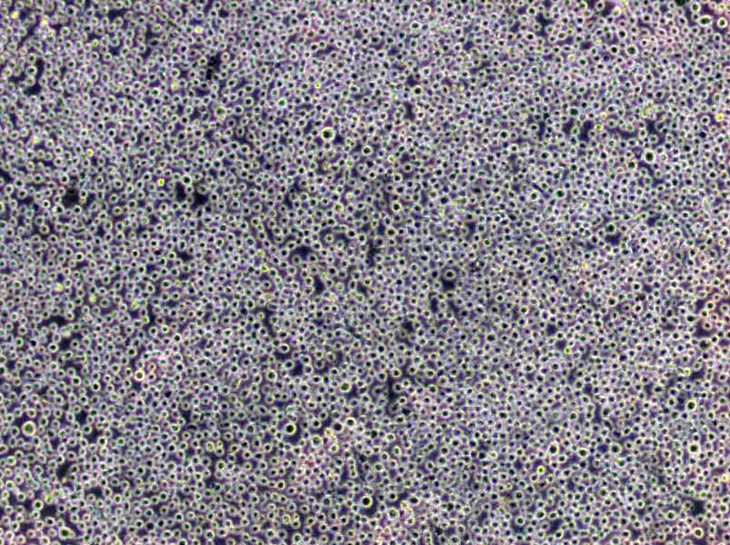 F-36P Cells(赠送Str鉴定报告)|骨髓增生异常综合征细胞