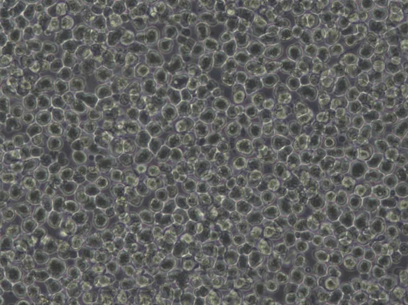 HCC1419 Cells(赠送Str鉴定报告)|人乳腺导管癌细胞