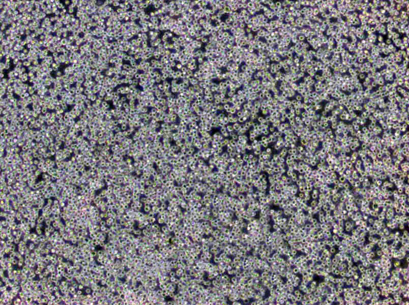 改良番茄汁琼脂粉末培养基