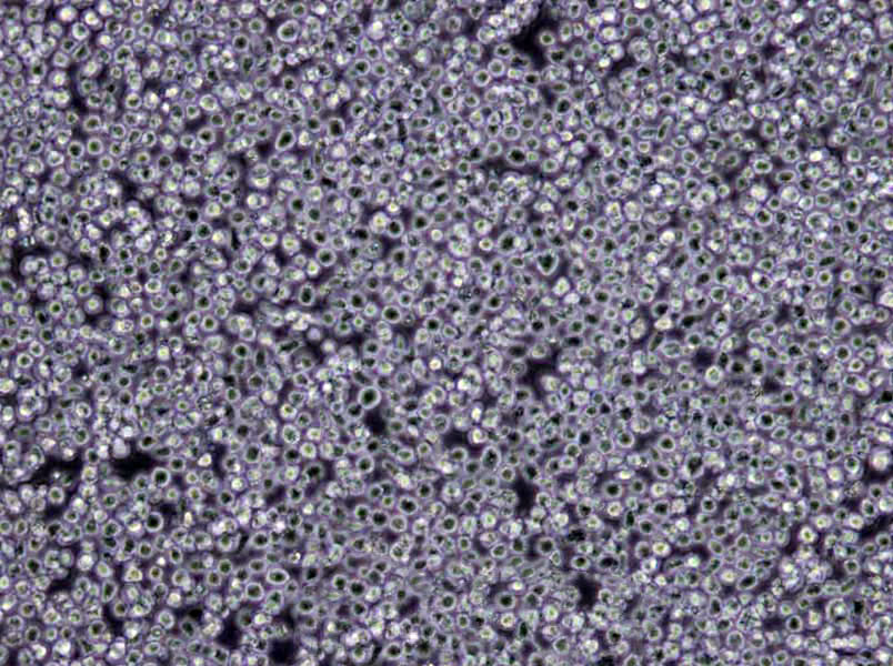 自诱导TB肉汤粉末培养基