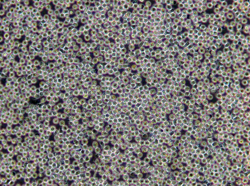 根瘤菌干粉培养基[YM]