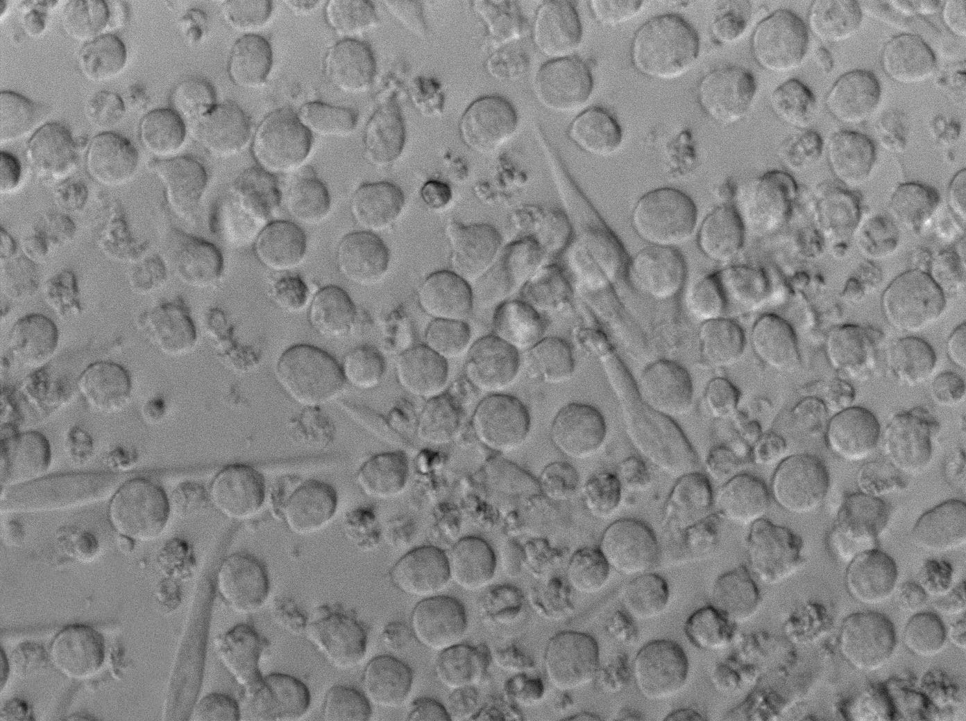 选择性APS超级肉汤细粉末培养基