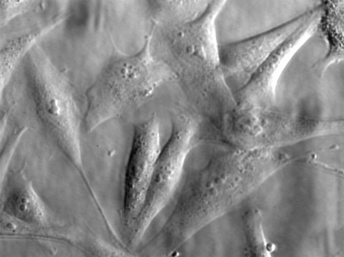 酸性肉汤固体粉末培养基