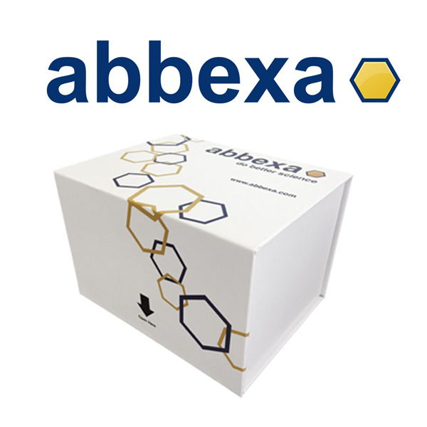 Human Hepatitis D Virus IgM (HDV) ELISA Kit