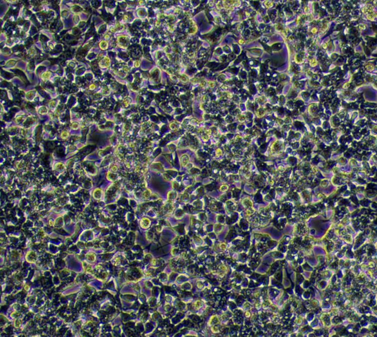 人胃癌顺铂耐药株SGC7901/DDP