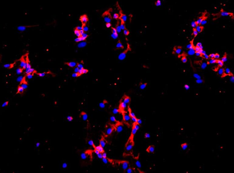 人关节软骨原代细胞