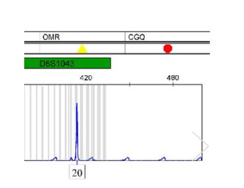 人牙周膜成纤维原代细胞