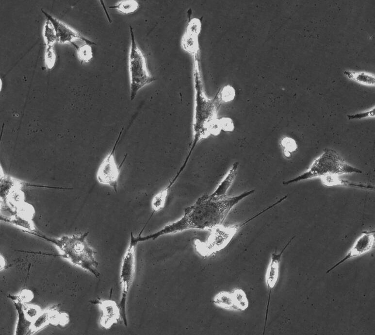 人椎间盘纤维环原代细胞