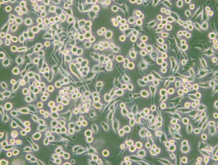 小鼠支气管成纤维原代细胞