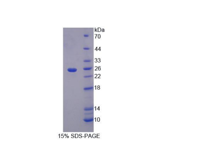 α1-B-糖蛋白(a1BG)重组蛋白