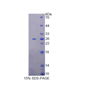 微小染色体维持缺陷蛋白5(MCM5)重组蛋白