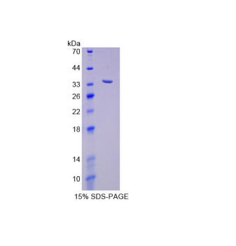 SHC-转化蛋白1(SHC1)重组蛋白