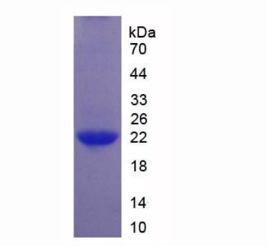 白介素1ζ(IL1z)重组蛋白