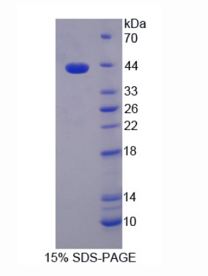 组蛋白脱乙酰基酶9(HDAC9)重组蛋白