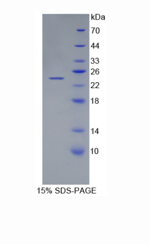 肌肽酶1(CNDP1)重组蛋白