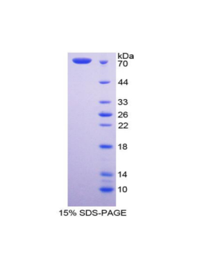 衰老关键蛋白4(FBLN4)重组蛋白