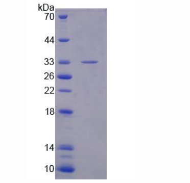 磷酸二酯酶10A(PDE10A)重组蛋白