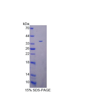 肽基精氨酸脱亚氨酶Ⅳ(PADI4)重组蛋白