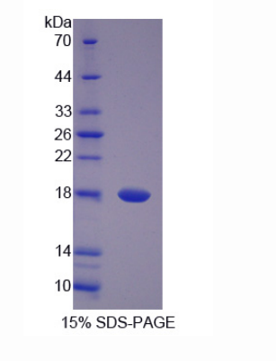 泛酸激酶4(PANK4)重组蛋白