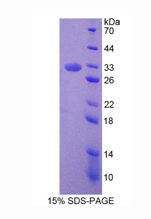 胞裂蛋白6(SEPT6)重组蛋白