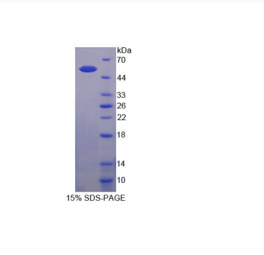 Sestrin 1蛋白(SESN1)重组蛋白