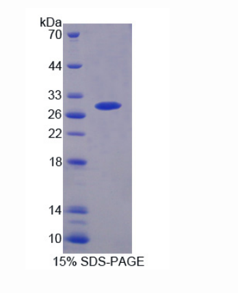 蛋白酶体亚基β6(PSMb6)重组蛋白
