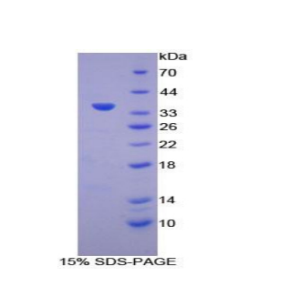 氢离子转运ATP酶溶酶体辅助蛋白2(ATP6AP2)重组蛋白