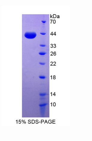 桥粒芯胶粘蛋白2(DSC2)重组蛋白
