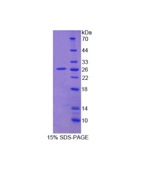 多巴脱羧酶(DDC)重组蛋白