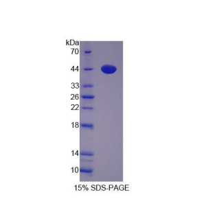 尿卟啉原脱羧酶(UROD)重组蛋白