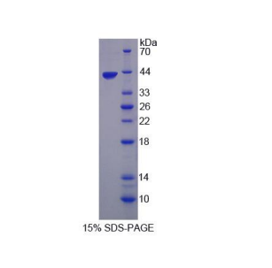 原肌球调节蛋白3(TMOD3)重组蛋白