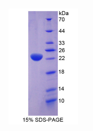 应激诱导磷蛋白1(STIP1)重组蛋白