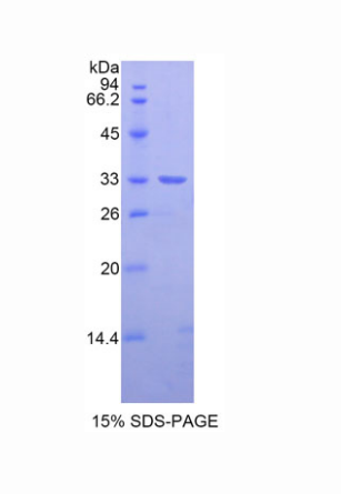 Nexn结合蛋白(NEXN)重组蛋白