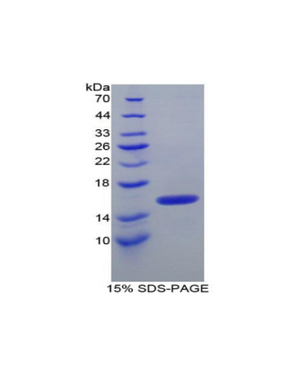中间α-球蛋白抑制因子H4(ITIH4)重组蛋白