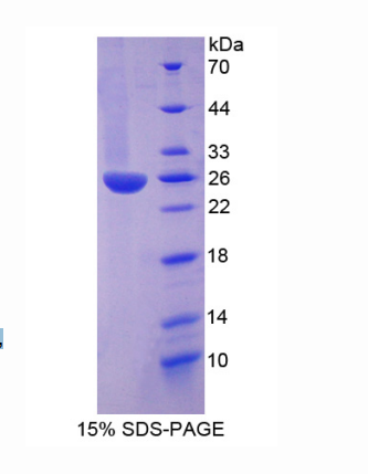 中间α-球蛋白抑制因子H3(ITIH3)重组蛋白