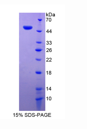解聚蛋白(DSTN)重组蛋白