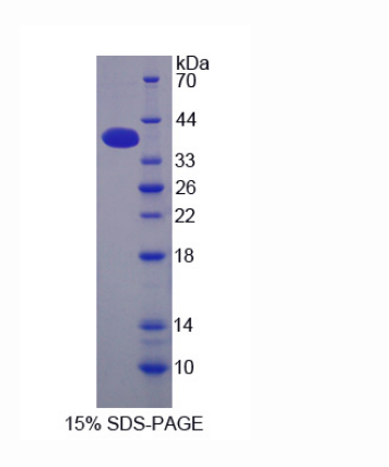 剪切多聚腺苷酸化特异性因子1(CPSF1)重组蛋白
