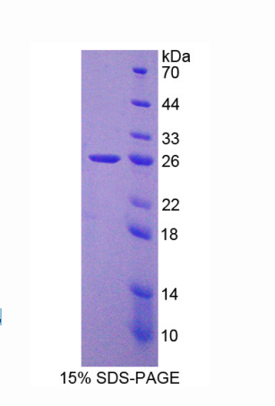 染色质装配因子1亚基B(CHAF1B)重组蛋白