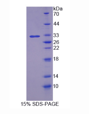 BMP结合内皮调节因子(BMPER)重组蛋白