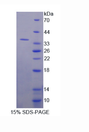 细胞骨架活性调节蛋白(ARC)重组蛋白