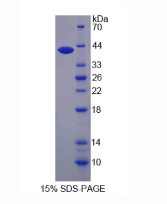 桥粒联结蛋白(AHNAK)重组蛋白