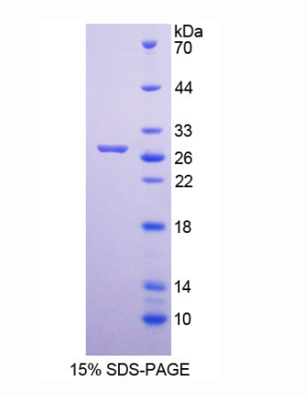 MutY同源物(MUTYH)重组蛋白