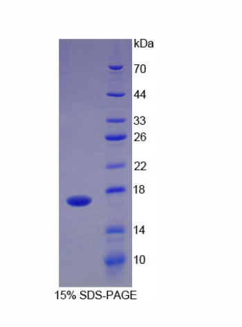 血小板反应蛋白解整合素金属肽酶4(ADAMTS4)重组蛋白