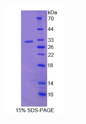 解整合素金属蛋白酶12(ADAM12)重组蛋白
