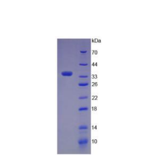 补体成分5a(C5a)重组蛋白