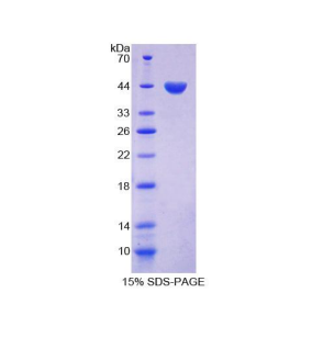 促卵泡素(FSH)重组蛋白