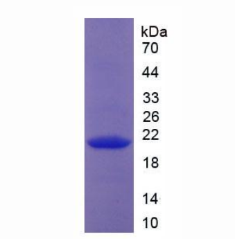ⅩⅧ型胶原(COL18)重组蛋白
