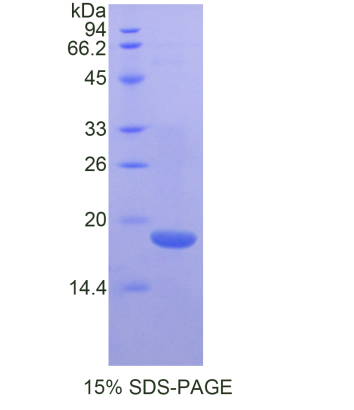 δ样蛋白1同源物(dLK1)重组蛋白