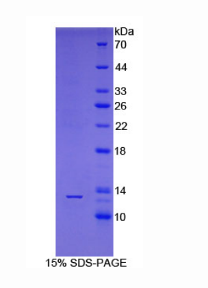 胞浆多聚A结合蛋白1样蛋白(PABPC1L)重组蛋白