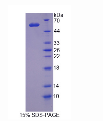 减数分裂重组11同源物A(MRE11A)重组蛋白